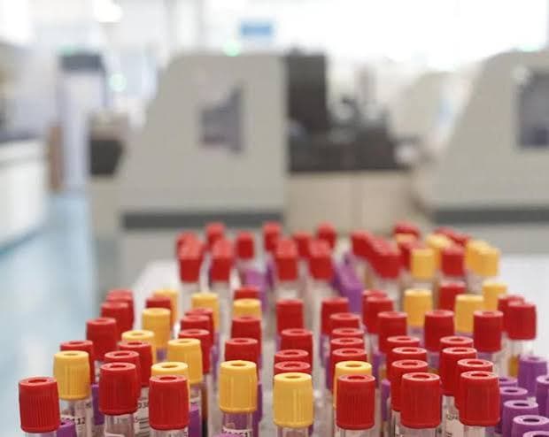 Malaria a Francoforte, salgono a otto i casi: tre le vittime nell’area dell’aeroporto