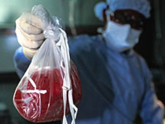 Ucraina, quattro sanitari indagati per prelievo e commercio illecito di tessuti umani