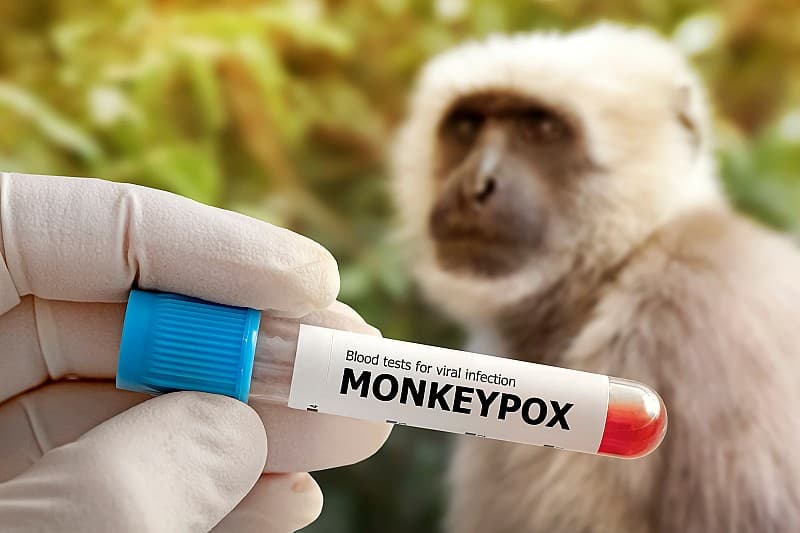 Mpox Vaiolo delle scimmie, allerta in Piemonte: sette nuovi casi
